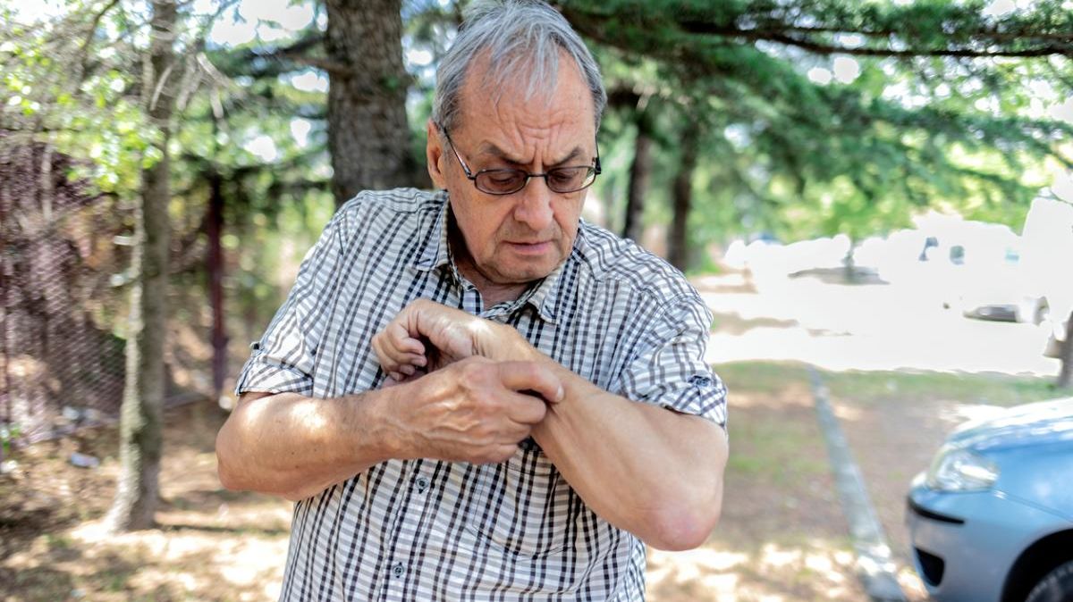 Ein älterer Mann mit Brille und kurzem Hemd kratzt sich am linken Arm.