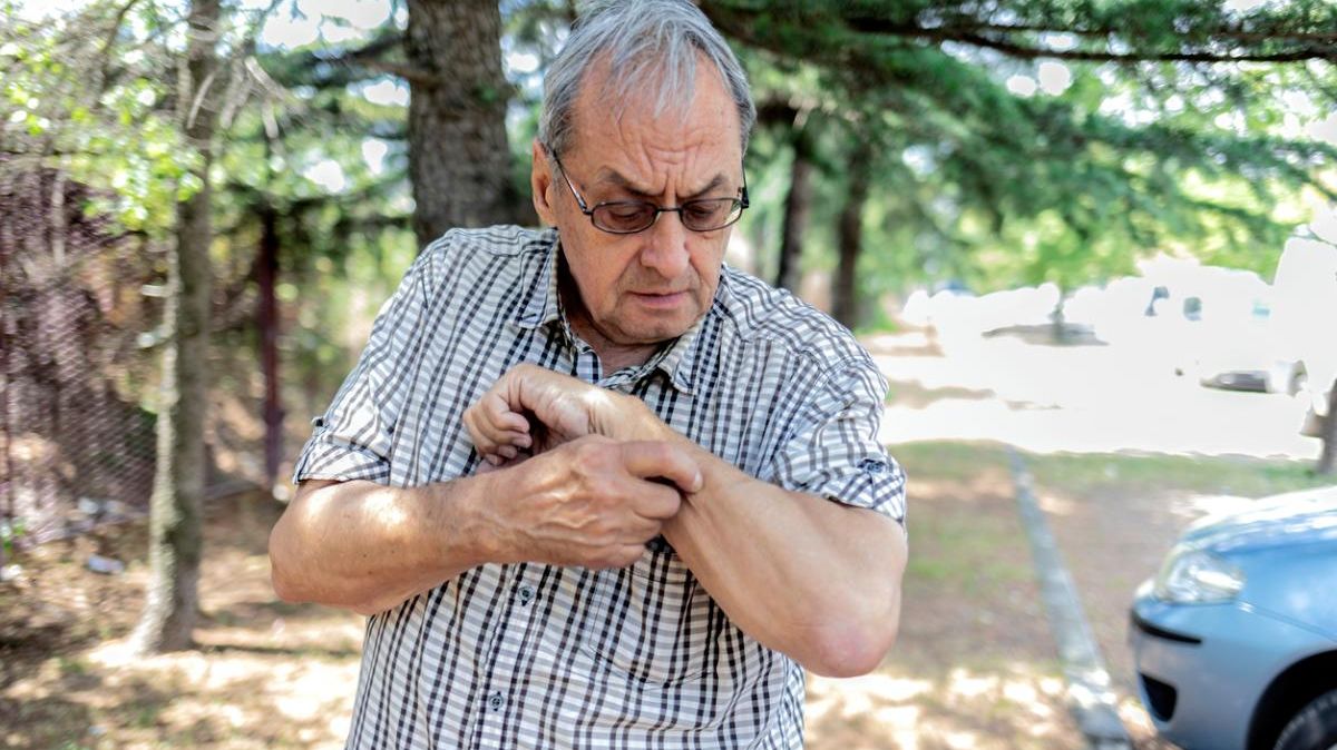 Ein älterer Mann mit Brille und kurzem Hemd kratzt sich am linken Arm.