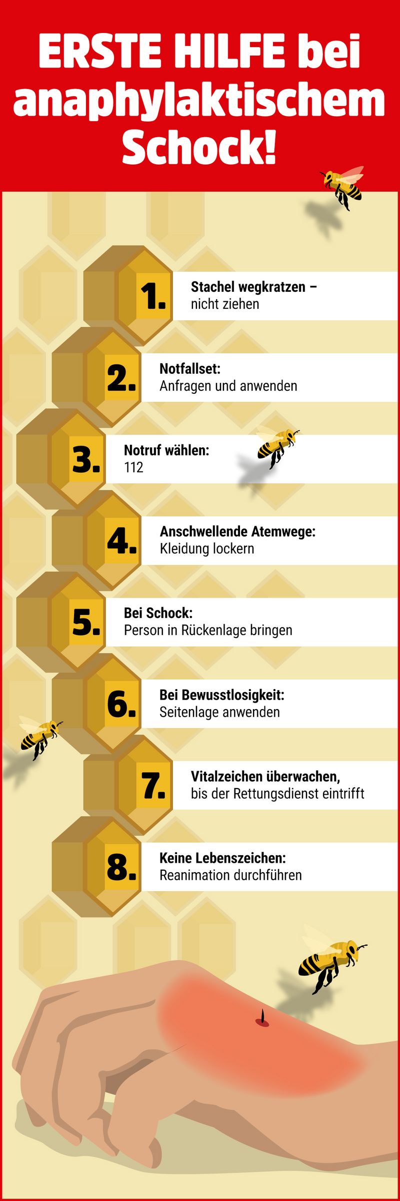 Infografik zu Insektenstichen.