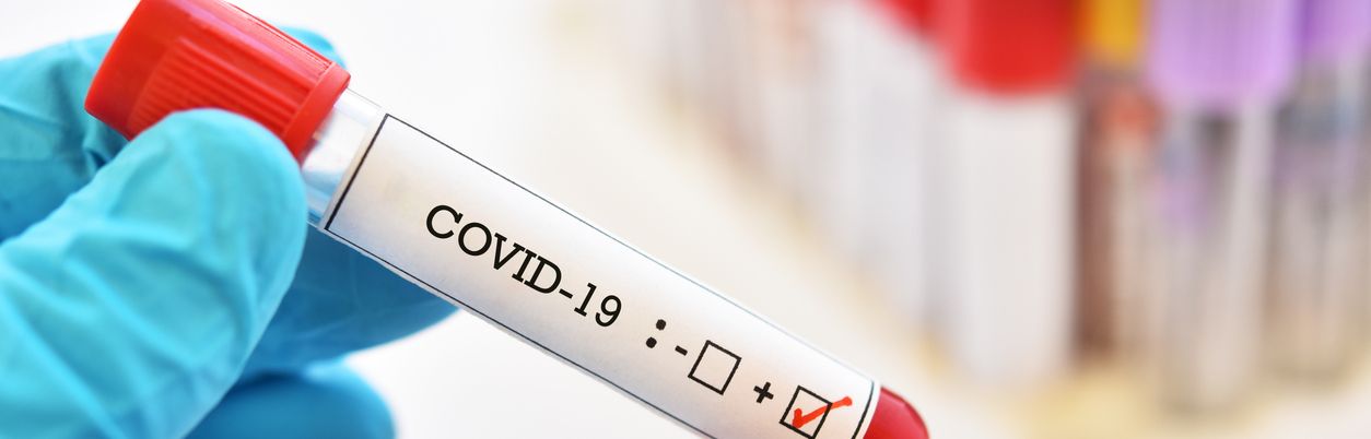 Eine Testkanüle mit der Aufschrift "Covid-19"