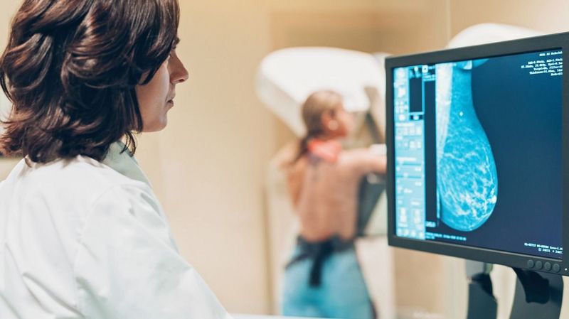 Eine Ärztin führt eine Mammographie an einer Frau durch.